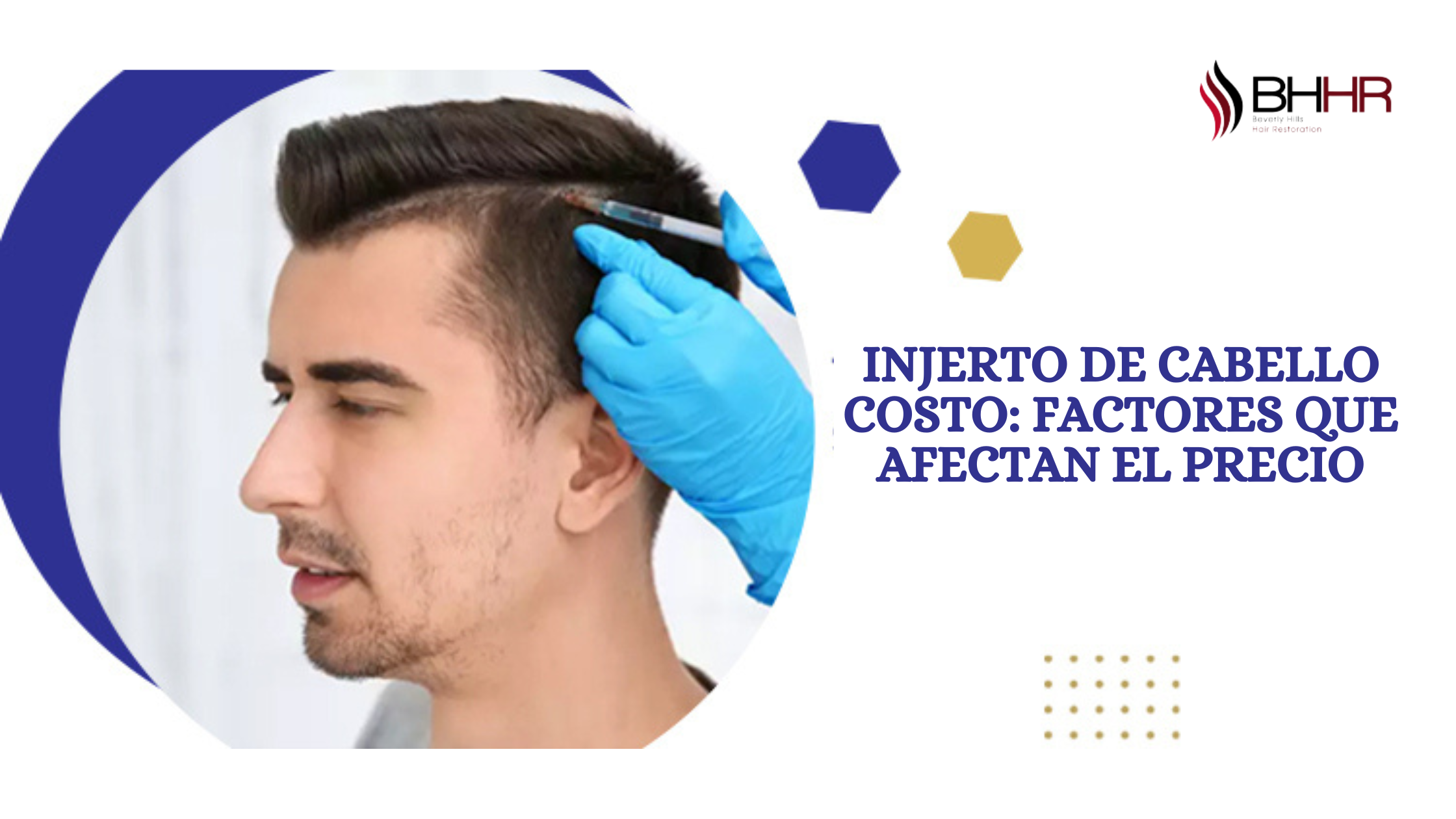 injerto de cabello costo