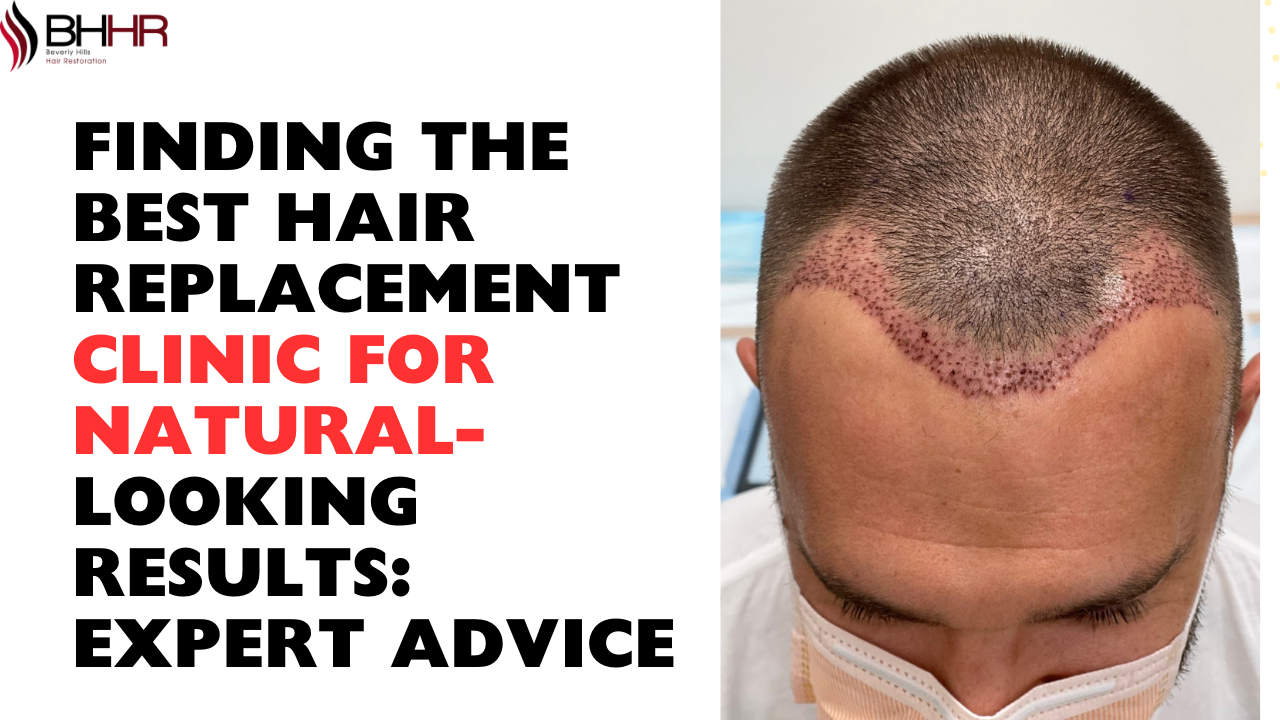 Finding the Best Hair Replacement Clinic for Natural-Looking Results: Expert Advice