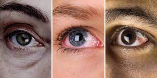 Excellent Information About Eye Care In The Article Below