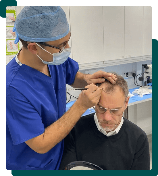 hair transplant London price